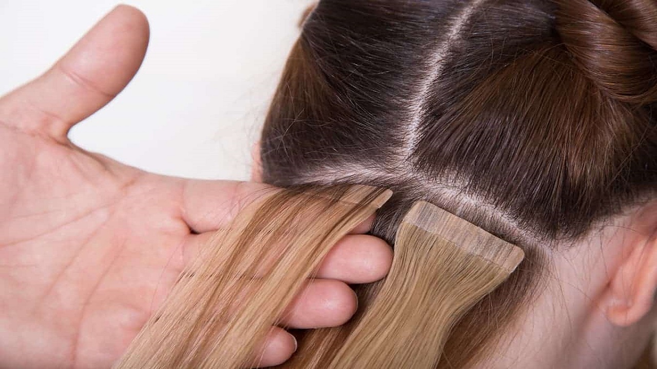 Invisible Hair Extensions for Post-Surgery Recovery: Restoring Confidence